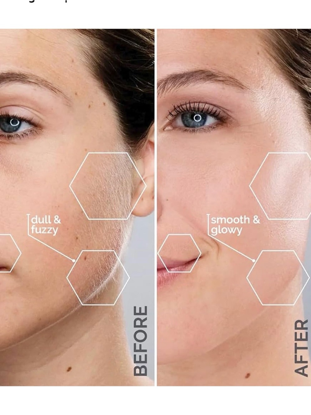 Michael Todd Beauty Sonicsmooth Pro+ Dermaplaning Microdermabrasion System NEW - Picture 5 of 14